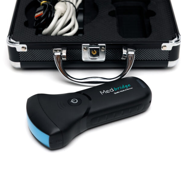 Alternative view of Φορητή Κεφαλή Υπερήχου MedBridge Echo Wave CB-20